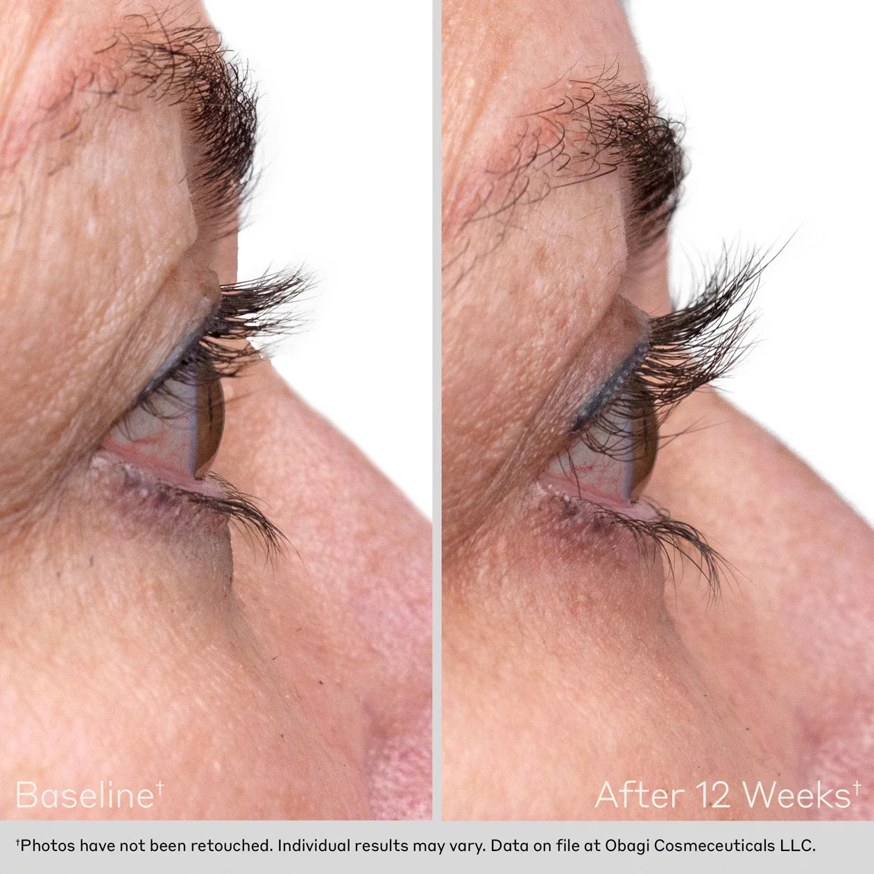 OBAGI Eyelash Enhancing Serum