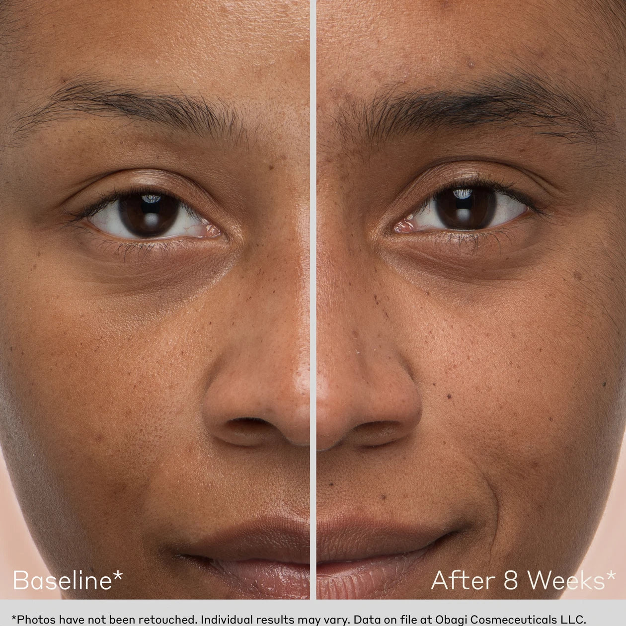 OBAGI Eyebrow Boosting Serum