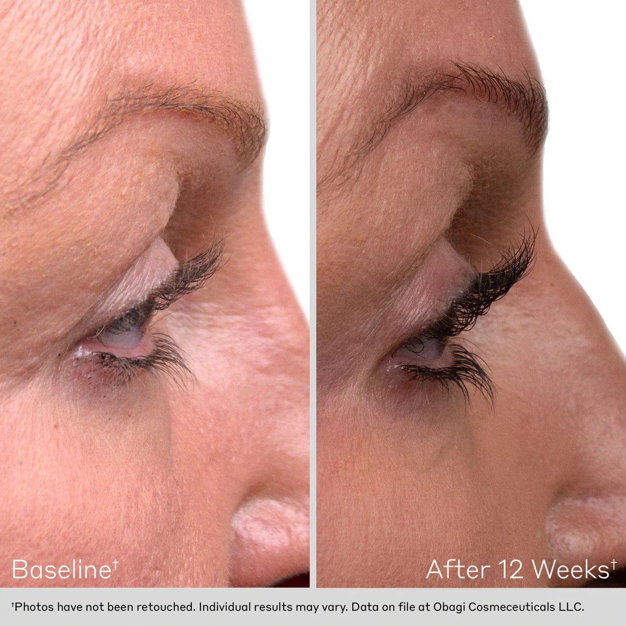 OBAGI Eyelash Enhancing Serum