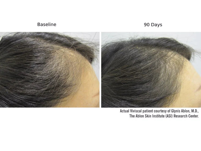 Viviscal PRO Hair Growth Supplement - 180 Tablets
