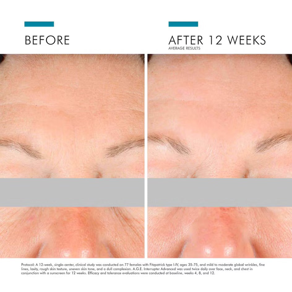 SkinCeuticals A.G.E. Interrupter Advanced Anti-Wrinkle Cream