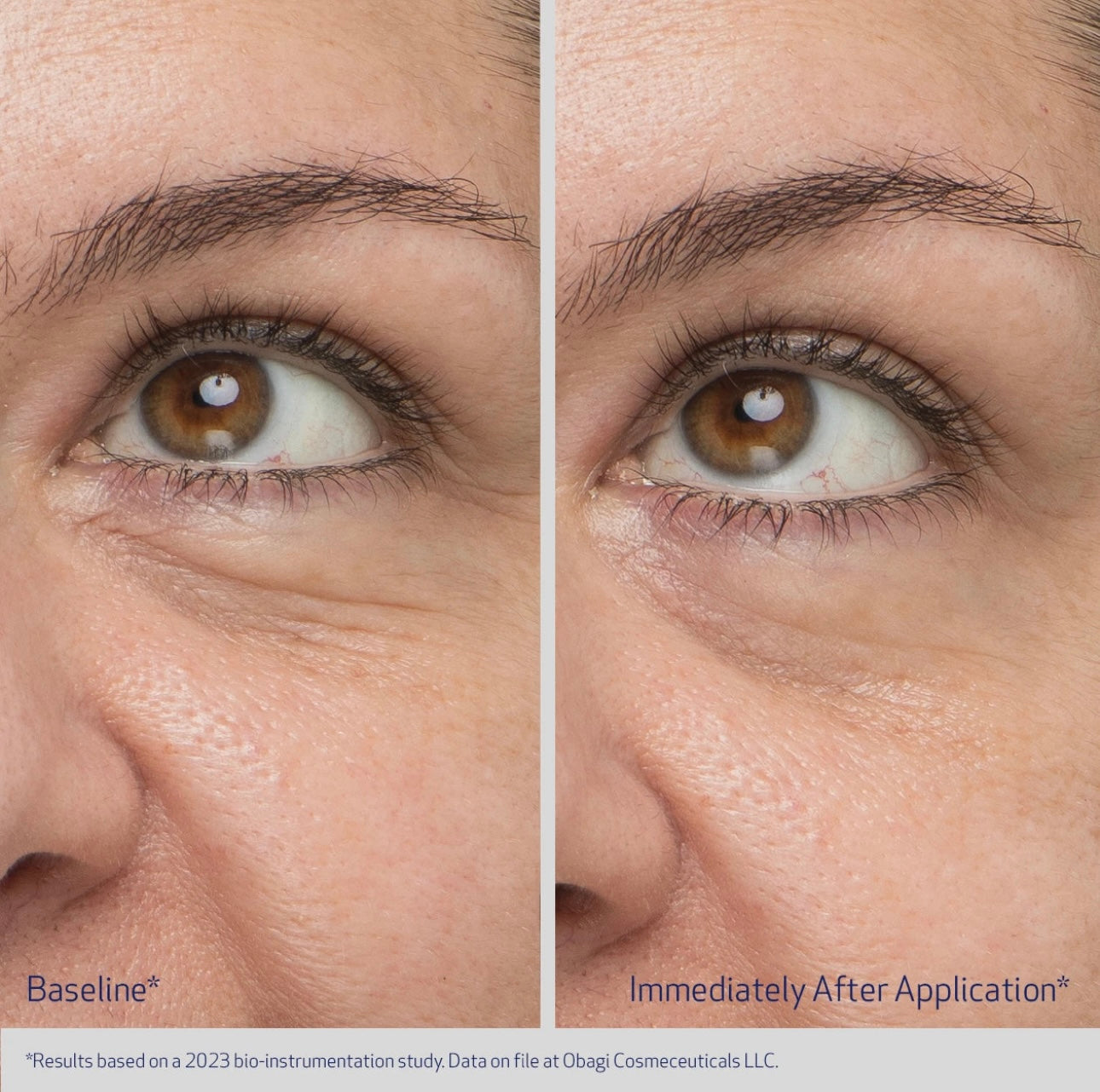 OBAGI Daily Hydro-Drops Rejuvenating Eye Gel Cream